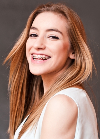 Teen girl with braces